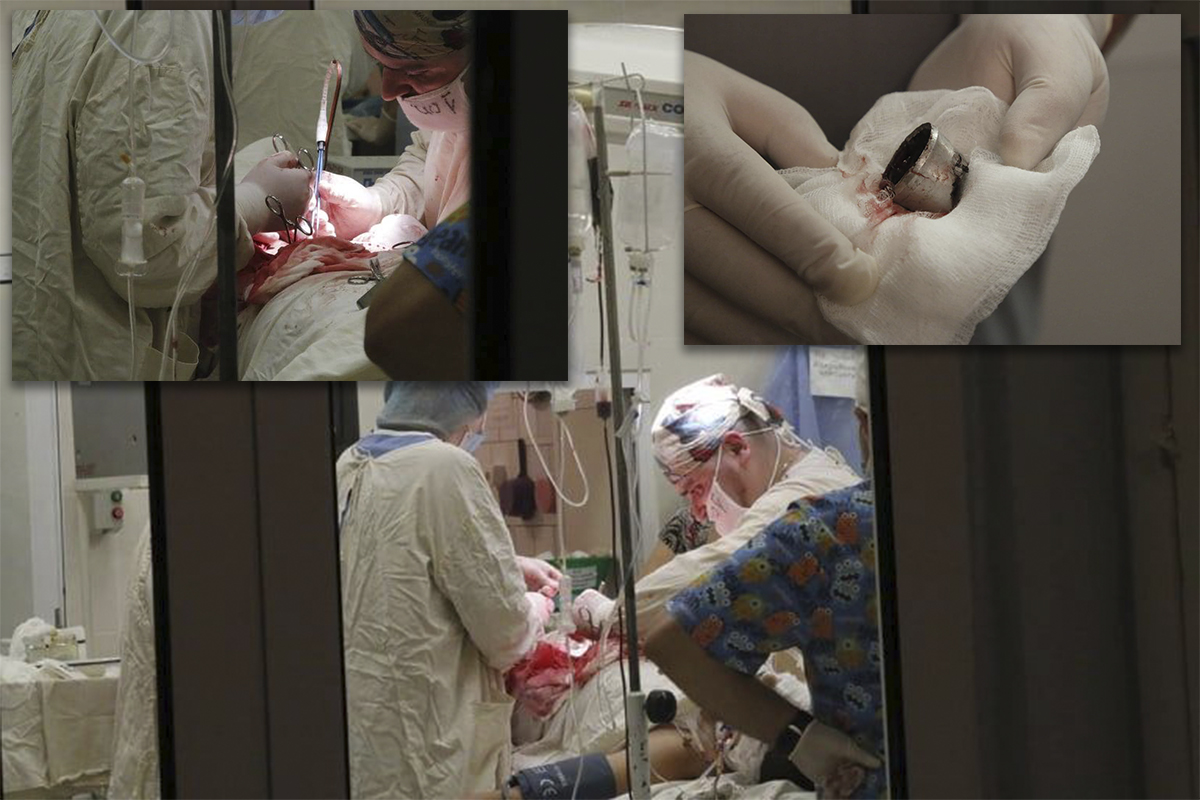 В оперционной хирурги спасают жизнь пострадавшего от взрыва ребенка